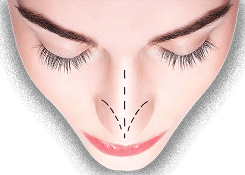 بهترین جراح بینی طبیعی در تهران